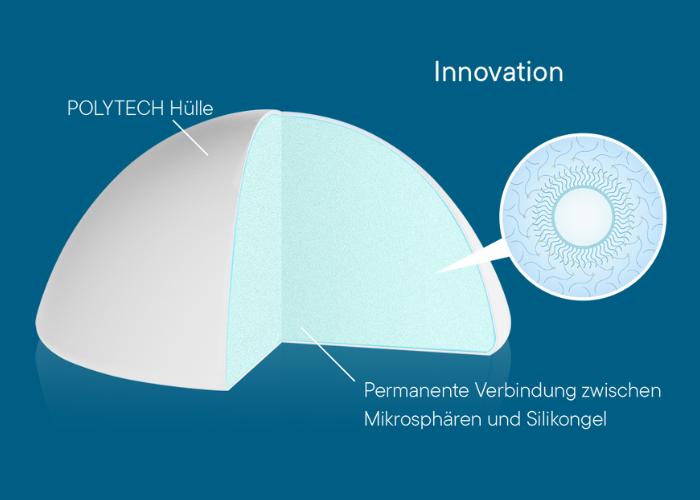 Aufbau B-Lite Implantate