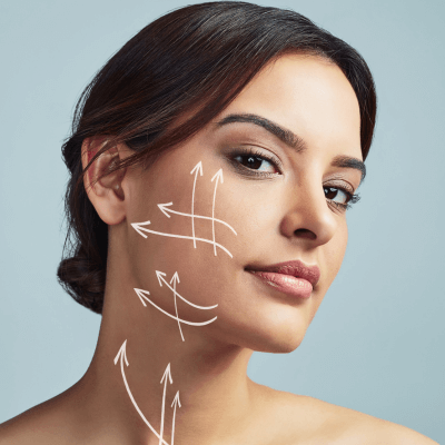 Patientin mit Linien im Gesicht die den Effekt eines Faceliftings demonstrieren