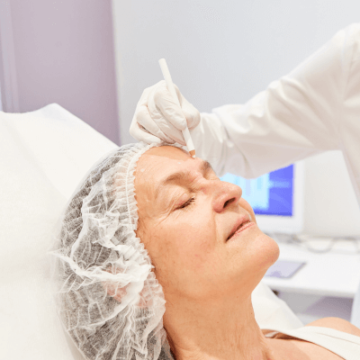 Dr. von Finckenstein zeichnet am Gesicht einer Patientin Linien an zur Vorbereitung des Faceliftings in München